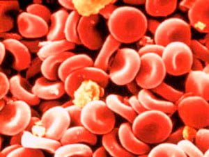 Кетоновые тела в крови норма фото