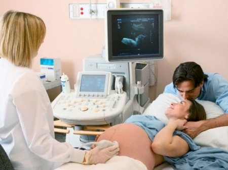 Определение даунизма при беременности фото