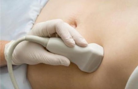 узи беременной для проверки ИАЖ фото