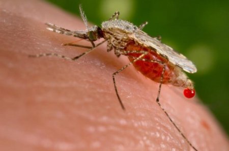 Малярия — симптомы, фото